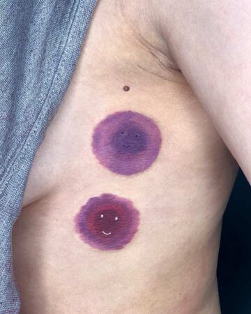 Two smiling, purple-toned tattoo designs smileys on a person's chest, a creative approach to post-mastectomy tattoo. This breast cancer awareness tattoo offers a hopeful and artistic representation of nipple reconstruction. Done by tattoo artists in our fine line tattoo studio parlour shop Canggu, Bali