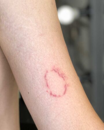 red tattoo on arm and shoulder bite imitation