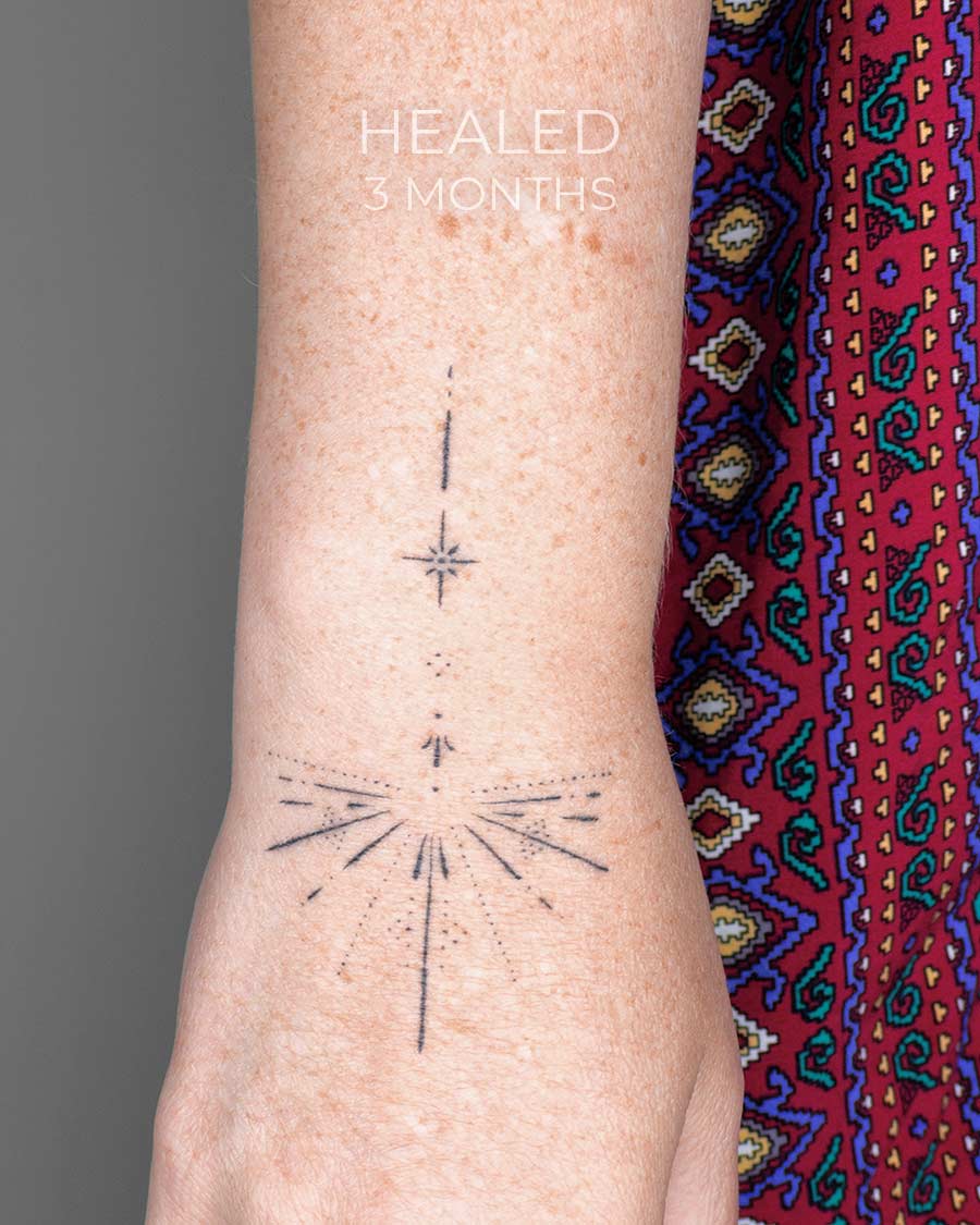healed tattoo Minimalist starburst tattoo on arm minimalist geometry by our artists in fine line tattoo studio Canggu Bali