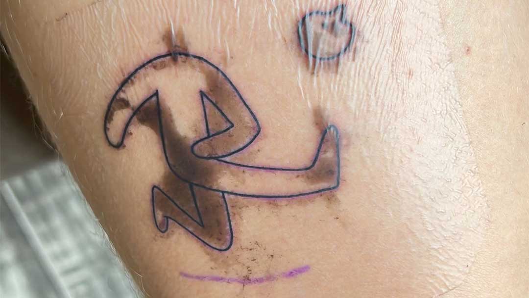 Small stick figure tattoo healing with second skin,, black and grey fine line tattoo Canggu, arm tattoo under Second Skin bandage, proper tattoo aftercare in Bali